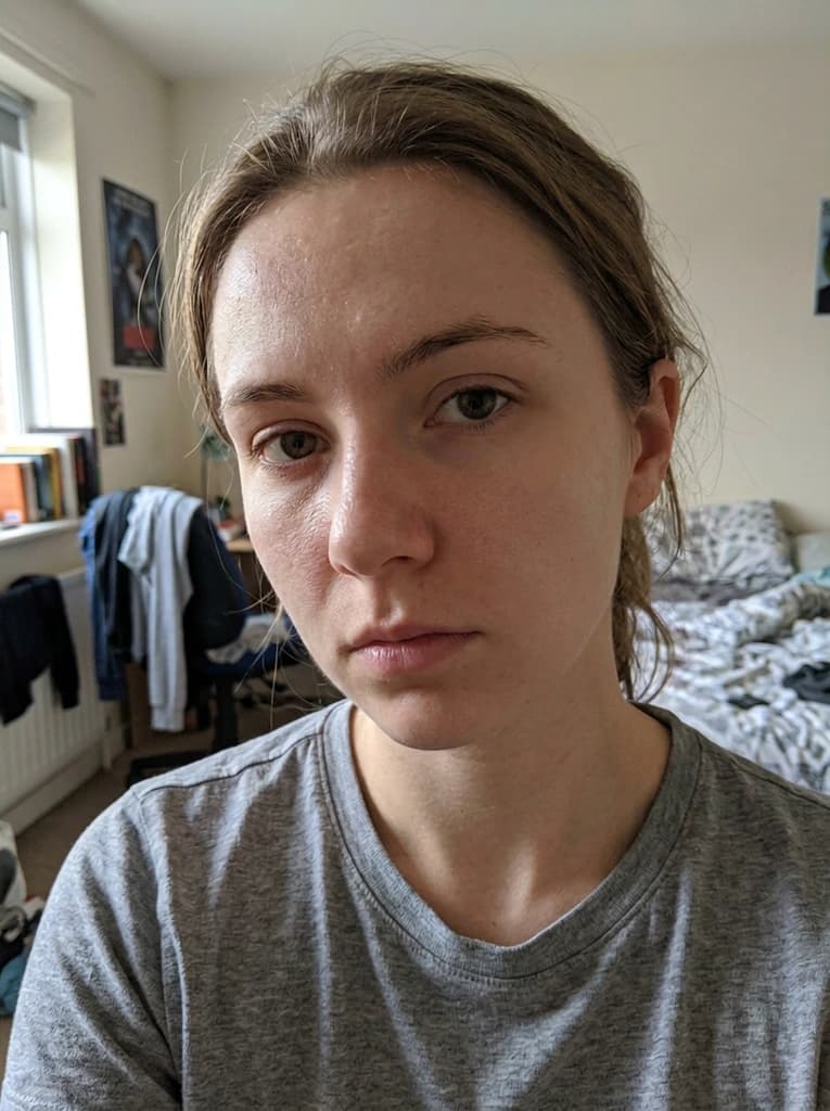 Woman's face after small blemishes and spots were cleared, natural skin texture kept